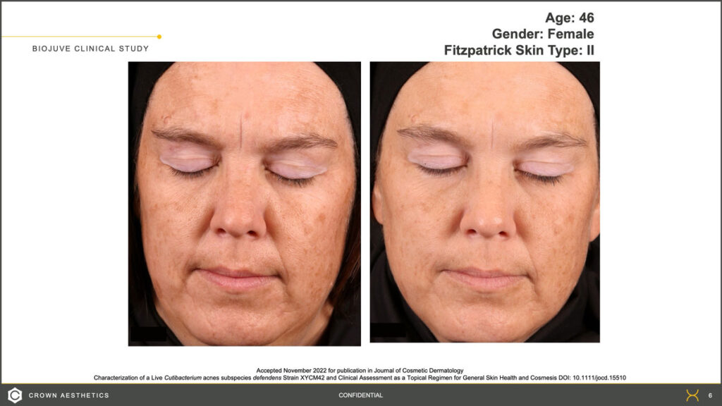 closeup of face before & after treatment