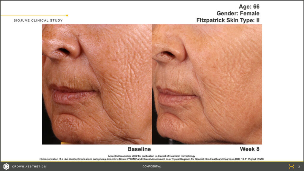 closeup of face before & after treatment