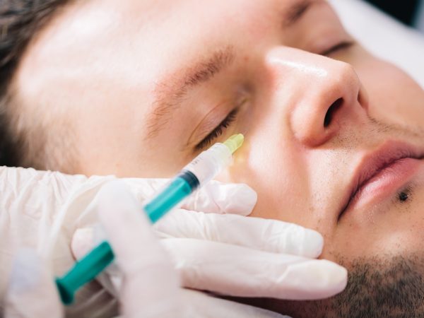 Injectable tissue stimulator on man face in beauty salon. Aesthetic medicine